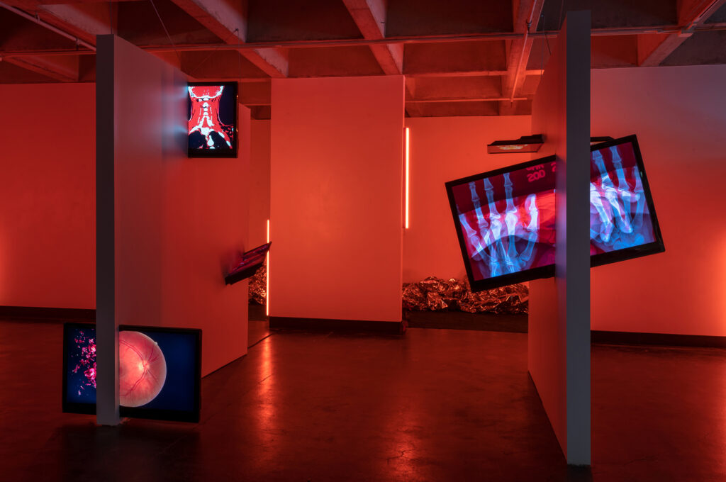 Gallery with dim red light showing x-rays of body parts attached to walls